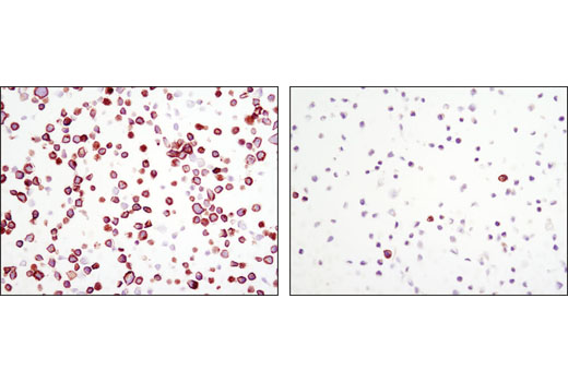 Immunohistochemistry Image 5: Phospho-Met (Tyr1234/1235) (D26) XP® Rabbit mAb (BSA and Azide Free)