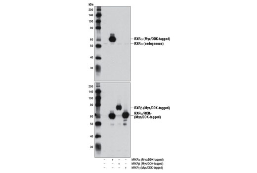 Image 7: Retinoic Acid and Retinoid X Receptors Antibody Sampler Kit