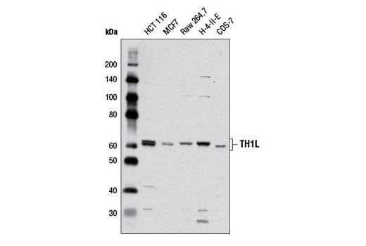 Western Blotting Image 1: TH1L Antibody
