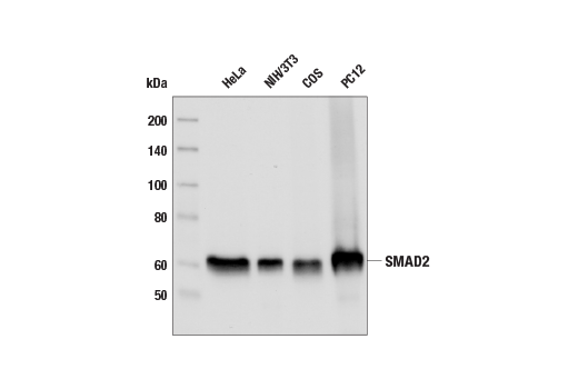 Western Blotting Image 1: SMAD2 (L16D3) Mouse mAb