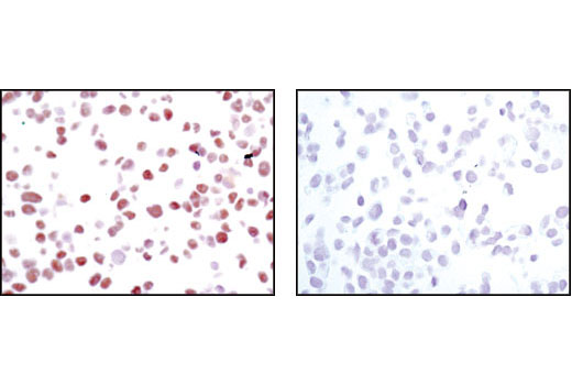 Immunohistochemistry Image 2: HNF4α (C11F12) Rabbit mAb