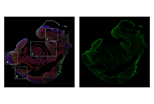 Immunofluorescence Image 1: TWIST1 (E7E2G) Rabbit mAb (IF Formulated)