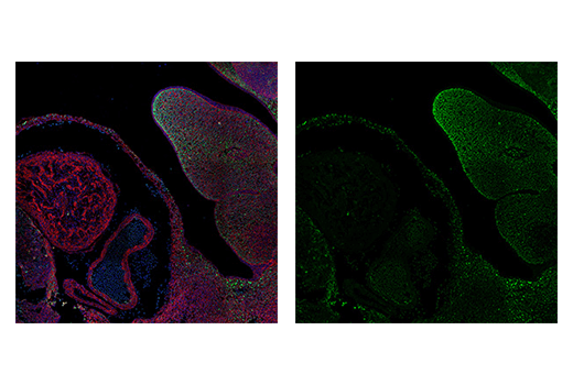 Immunofluorescence Image 4: TWIST1 (E7E2G) Rabbit mAb (IF Formulated)