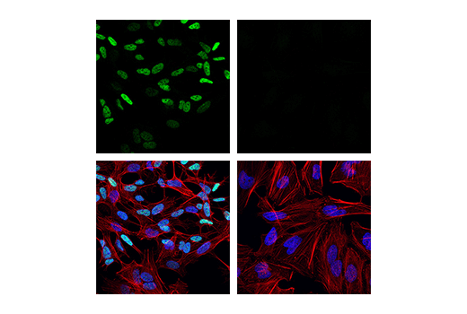 Immunofluorescence Image 7: TWIST1 (E7E2G) Rabbit mAb (IF Formulated)