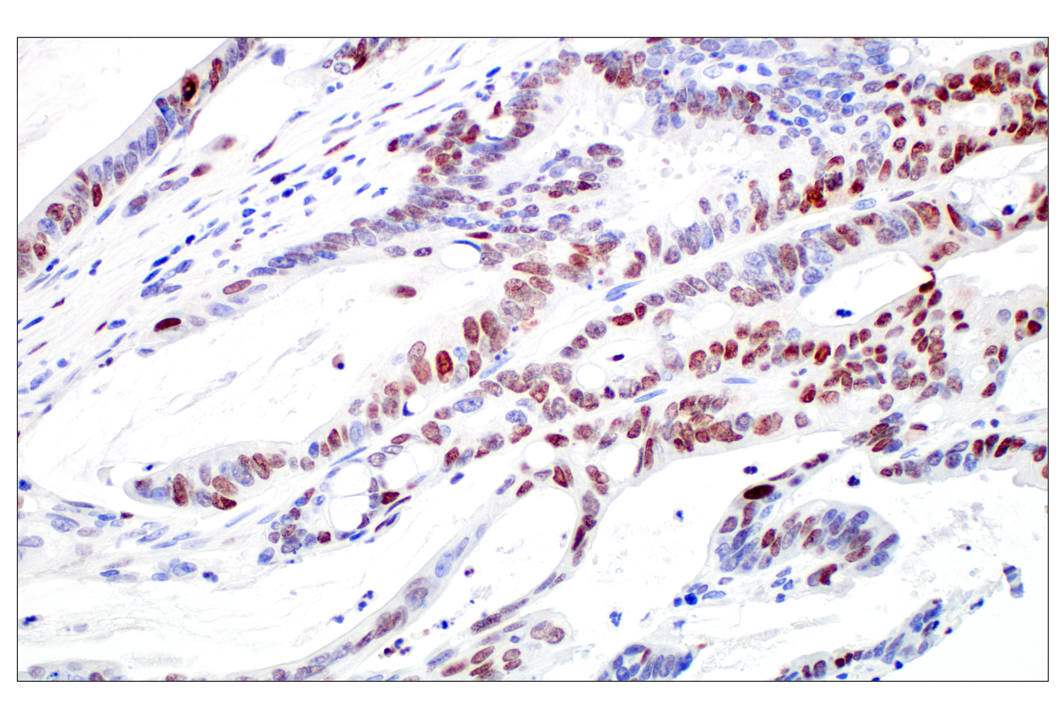 Immunohistochemistry Image 2: c-Fos (E2I7R) XP® Rabbit mAb