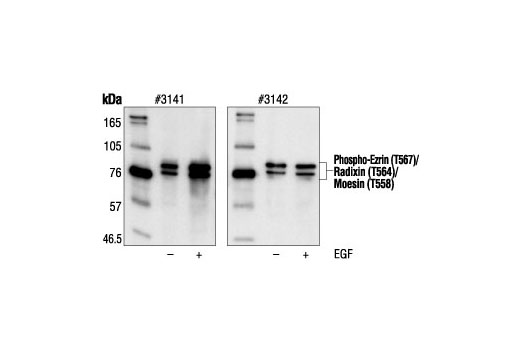 Western Blotting Image 1: Phospho-Ezrin (Thr567)/Radixin (Thr564)/Moesin (Thr558) Antibody