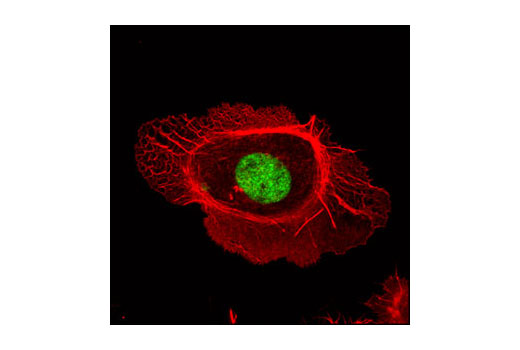 Immunofluorescence Image 1: FoxA2/HNF3β Antibody