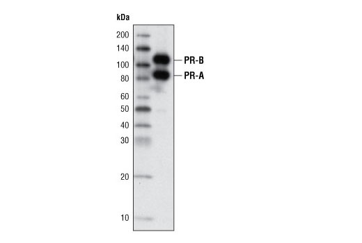 Western Blotting Image 1: Progesterone Receptor A/B (C89F7) Rabbit mAb