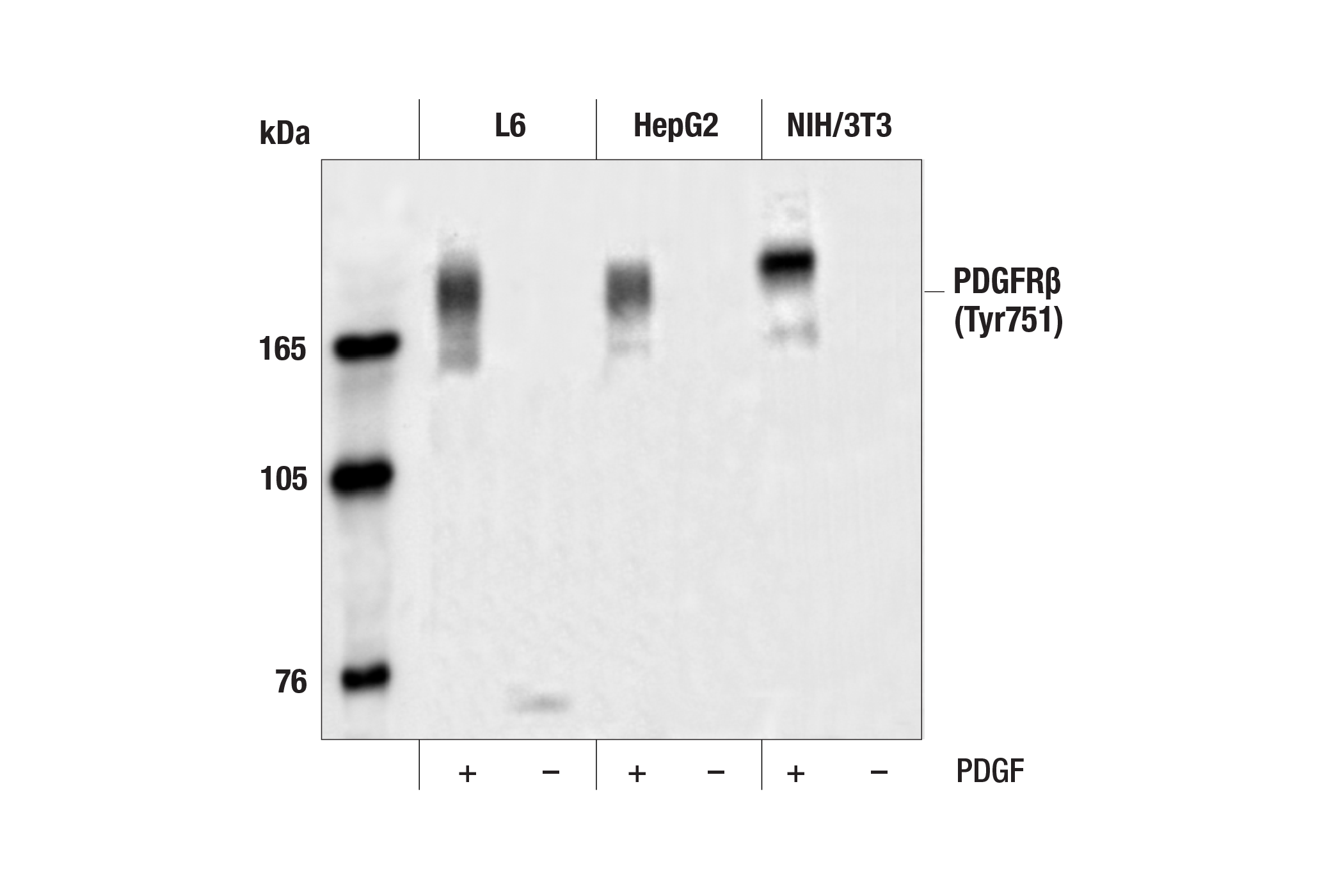 Western Blotting Image 1: Phospho-PDGF Receptor β (Tyr751) Antibody