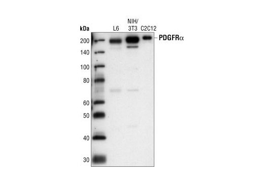 Western Blotting Image 1: PDGF Receptor α Antibody