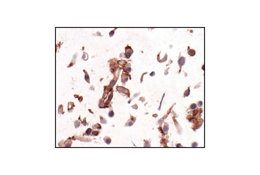 Immunohistochemistry Image 3: PDGF Receptor β (28E1) Rabbit mAb