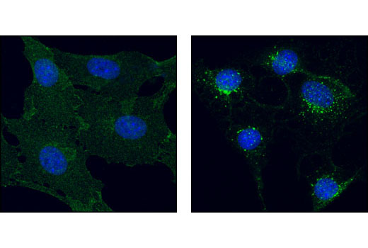 Immunofluorescence Image 3: PDGF Receptor β (28E1) Rabbit mAb