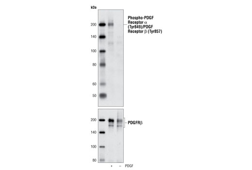 Western Blotting Image 1: Phospho-PDGF Receptor α (Tyr849)/PDGF Receptor β (Tyr857) (C43E9) Rabbit mAb