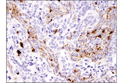  Image 36: Mouse Reactive Alzheimer's Disease Model Microglia Phenotyping IF Antibody Sampler Kit