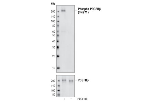  Image 8: PDGF Receptor β Antibody Sampler Kit