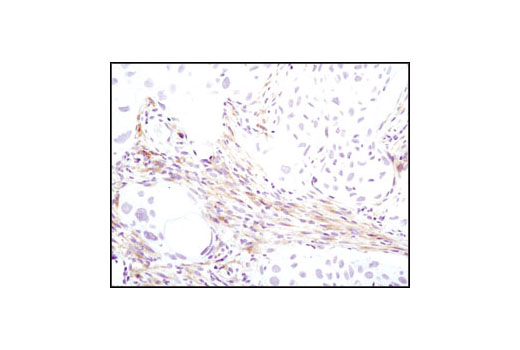  Image 10: PDGF Receptor α Antibody Sampler Kit