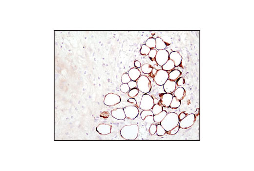 Immunohistochemistry Image 4: Fatty Acid Synthase (C20G5) Rabbit mAb