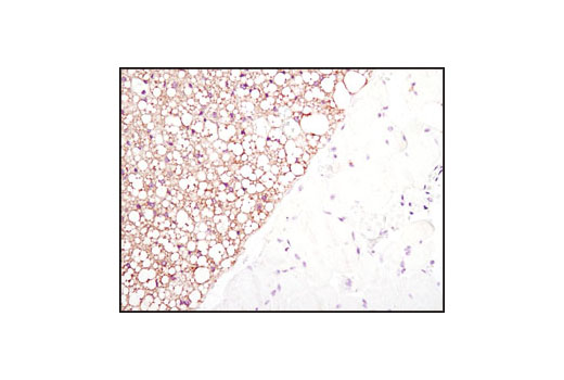  Image 25: Fatty Acid and Lipid Metabolism Antibody Sampler Kit