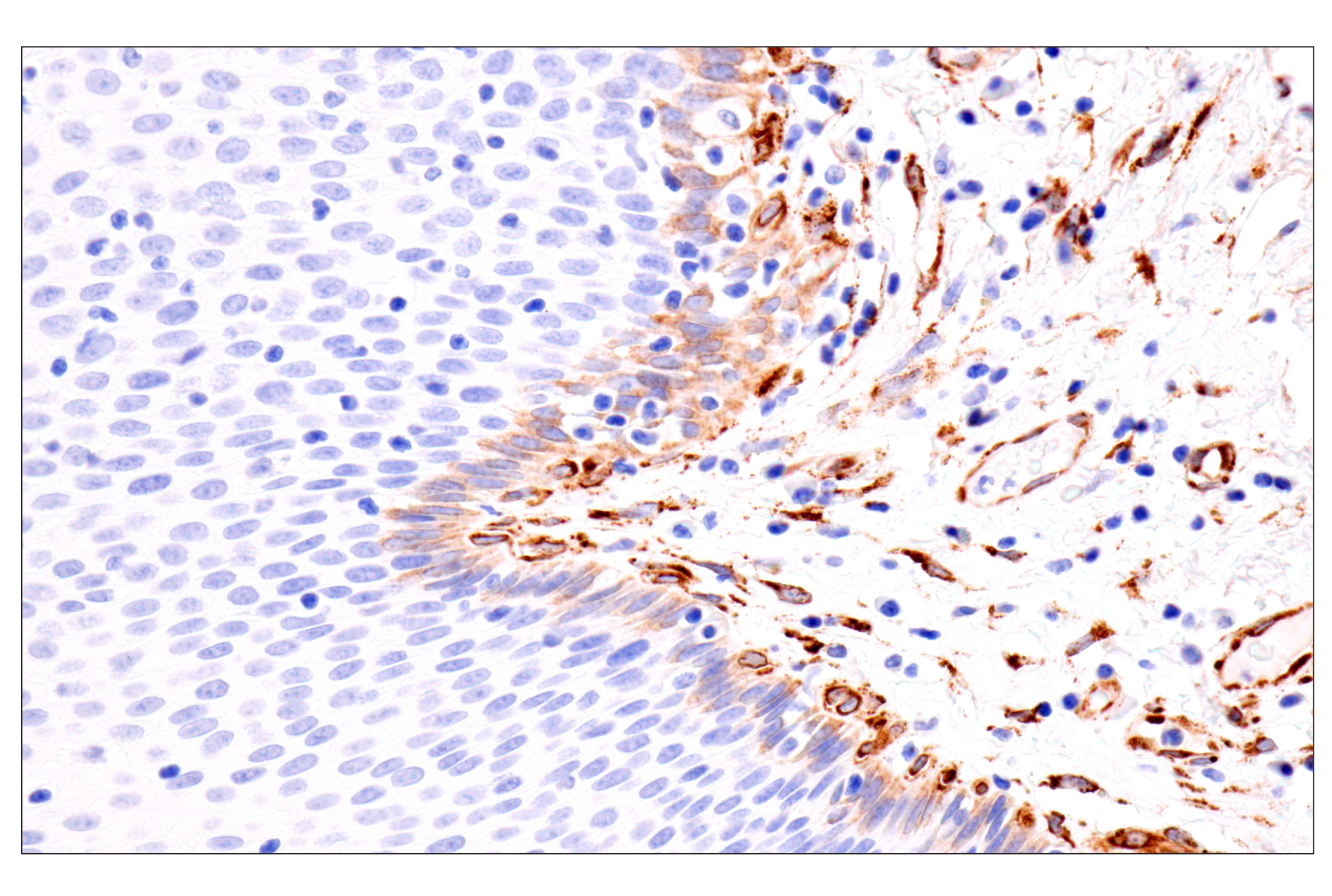 Immunohistochemistry Image 5: HSP47/SERPINH1 (E4A8P) Rabbit mAb