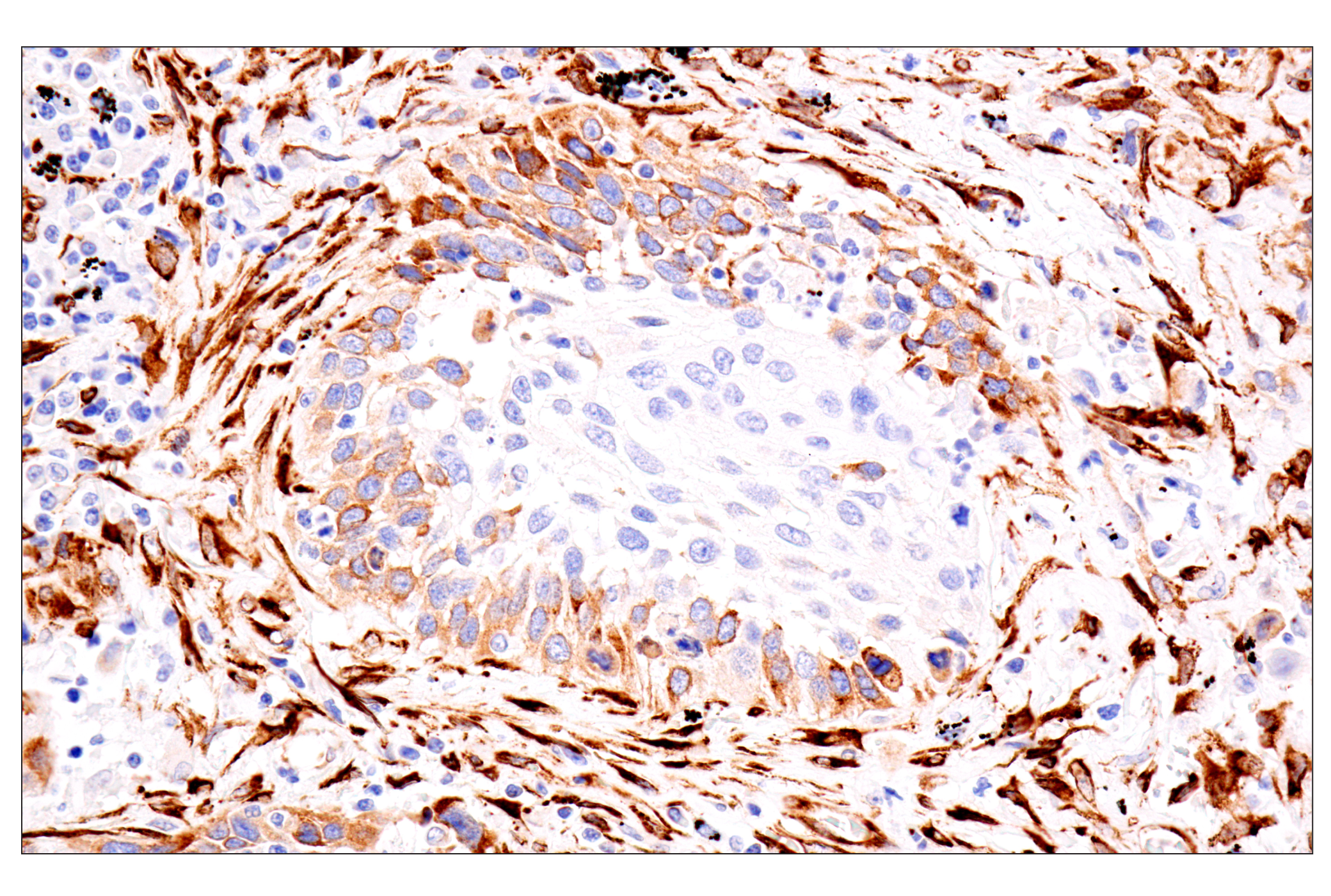 Immunohistochemistry Image 3: HSP47/SERPINH1 (E4A8P) Rabbit mAb