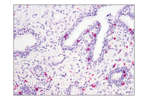 Immunohistochemistry Image 2: SignalStain® Boost IHC Detection Reagent (AP, Mouse)