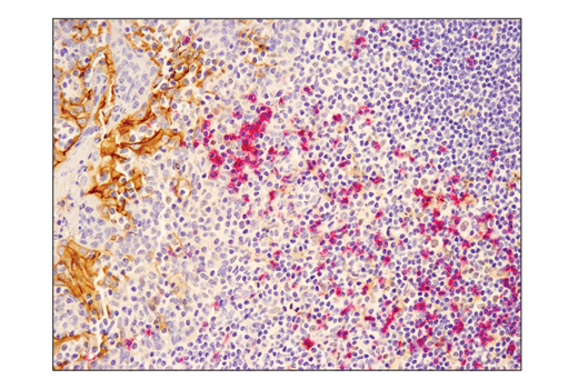 Immunohistochemistry Image 3: SignalStain® Boost IHC Detection Reagent (AP, Mouse)