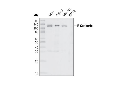  Image 11: Epithelial-Mesenchymal Transition (EMT) Antibody Sampler Kit