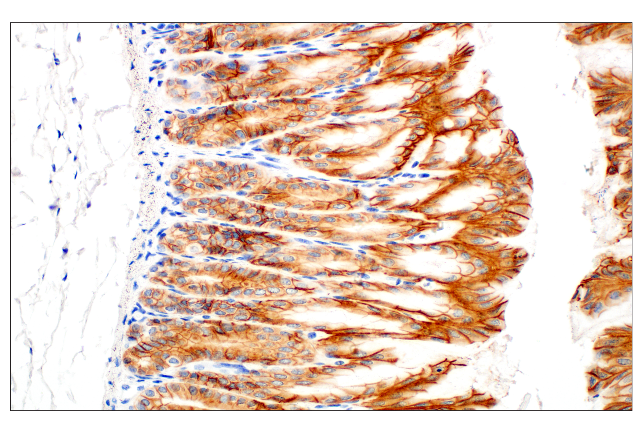  Image 64: Epithelial-Mesenchymal Transition (EMT) Antibody Sampler Kit
