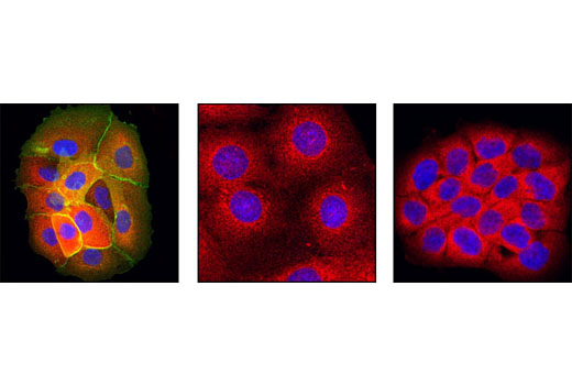 Immunofluorescence Image 1: EGF Receptor (L858R Mutant Specific) (43B2) Rabbit mAb