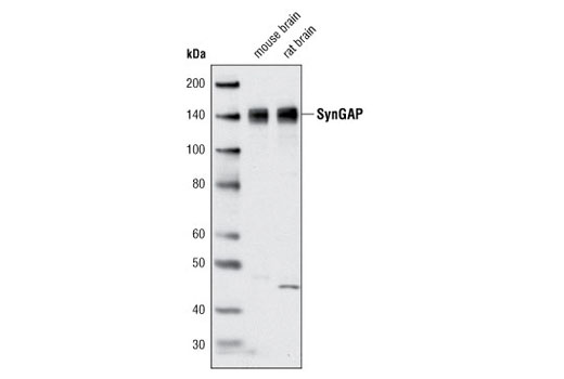 Western Blotting Image 1: SynGAP Antibody