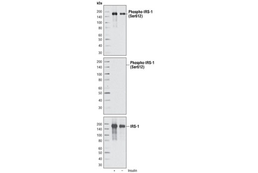  Image 2: Insulin Receptor Substrate Antibody Sampler Kit