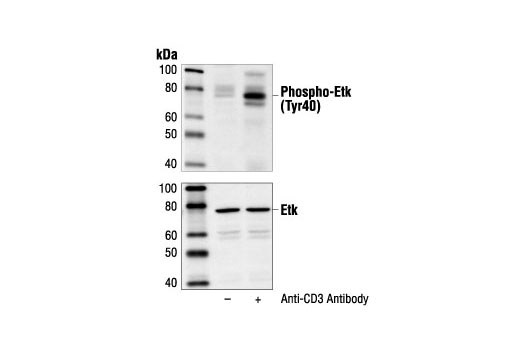 Western Blotting Image 1: Phospho-Etk (Tyr40) Antibody