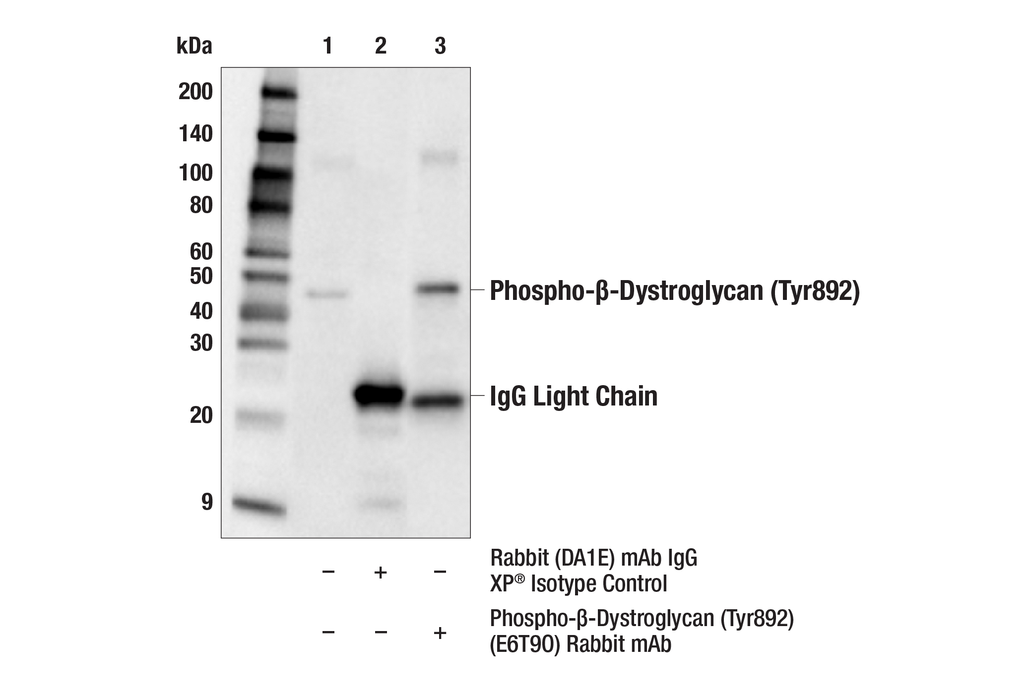 Immunoprecipitation Image 1: Phospho-β-Dystroglycan (Tyr892) (E6T9O) Rabbit mAb