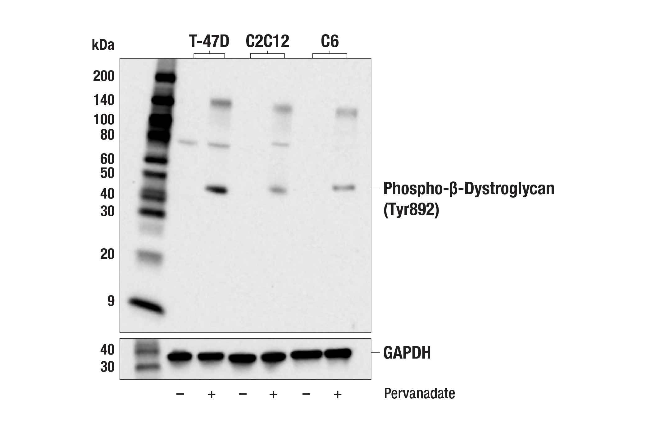 Western Blotting Image 1: Phospho-β-Dystroglycan (Tyr892) (E6T9O) Rabbit mAb