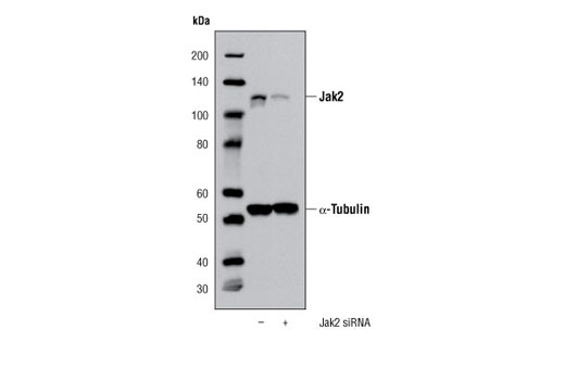  Image 3: PhosphoPlus® Jak2 (Tyr1007/Tyr1008) Antibody Duet
