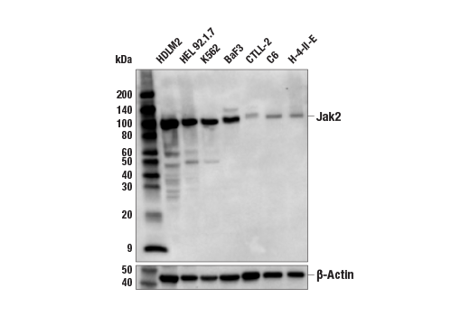  Image 1: PhosphoPlus® Jak2 (Tyr1007/Tyr1008) Antibody Duet