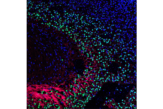 Immunofluorescence Image 1: TBR1 (D6C6X) Rabbit mAb (Alexa Fluor® 488 Conjugate)