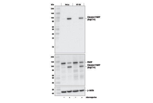  Image 13: Apoptosis Antibody Sampler Kit II