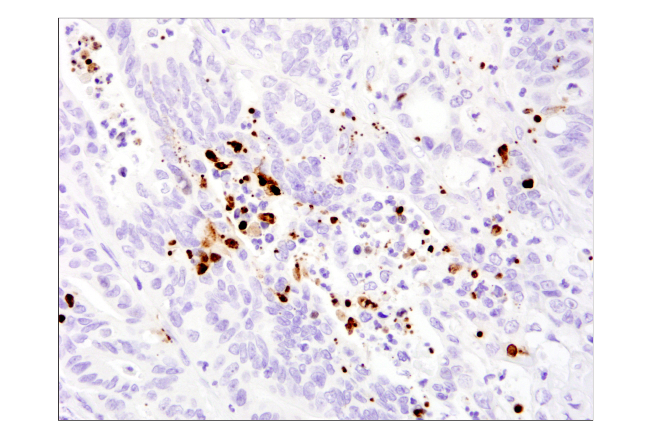Immunohistochemistry Image 2: Cleaved-PARP (Asp214) (E2T4K) Mouse mAb