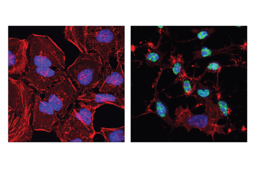 Immunofluorescence Image 1: Cleaved-PARP (Asp214) (E2T4K) Mouse mAb