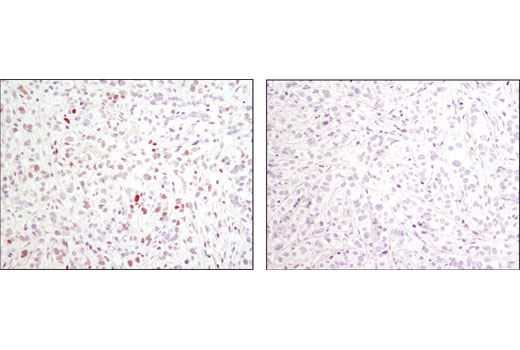 Immunohistochemistry Image 1: Phospho-c-Jun (Ser73) (D47G9) XP® Rabbit mAb