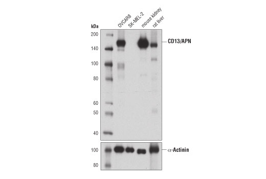  Image 6: Coronavirus Host Cell Attachment and Entry Antibody Sampler Kit