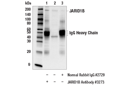 Immunoprecipitation Image 1: JARID1B Antibody