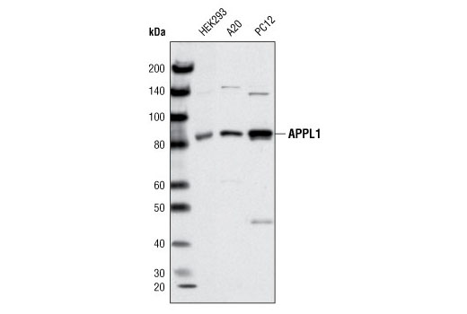 Western Blotting Image 1: APPL1 Antibody