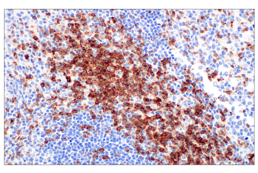 Immunohistochemistry Image 3: CD7 (E4G1Q) XP® Rabbit mAb (BSA and Azide Free)