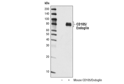 Western Blotting Image 1: CD105/Endoglin Antibody
