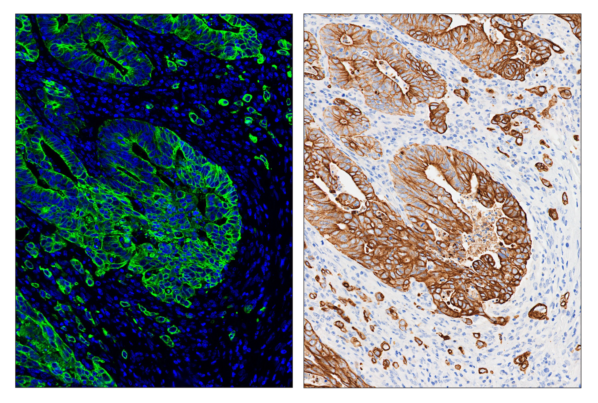Immunohistochemistry Image 6: Pan-Keratin (C11) & CO-0003-647 SignalStar™ Oligo-Antibody Pair