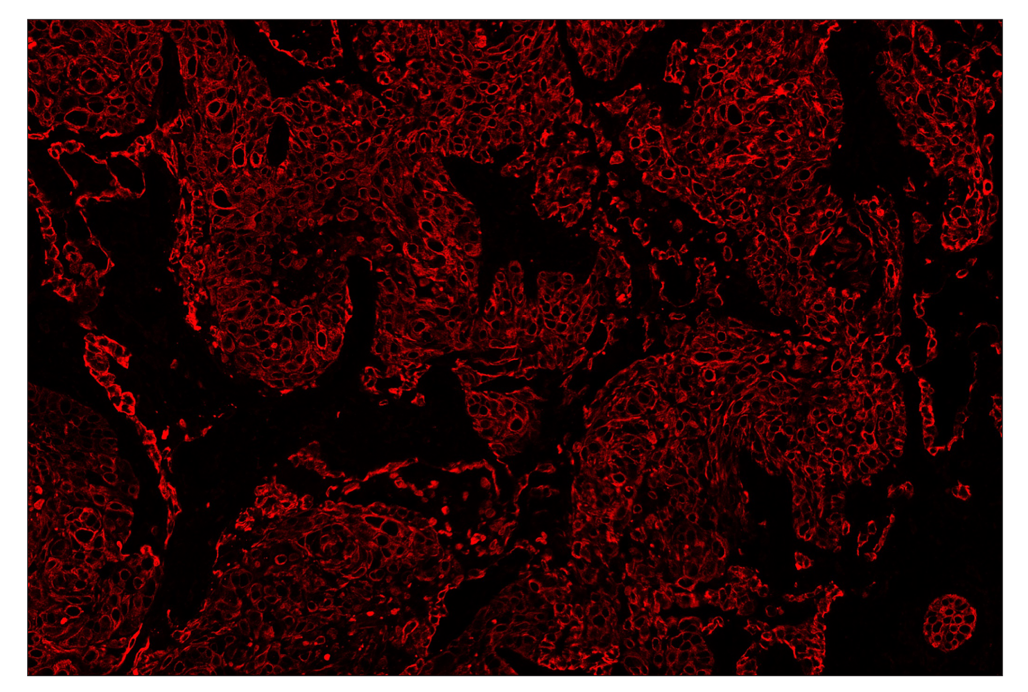 Immunohistochemistry Image 4: Pan-Keratin (C11) & CO-0003-594 SignalStar™ Oligo-Antibody Pair