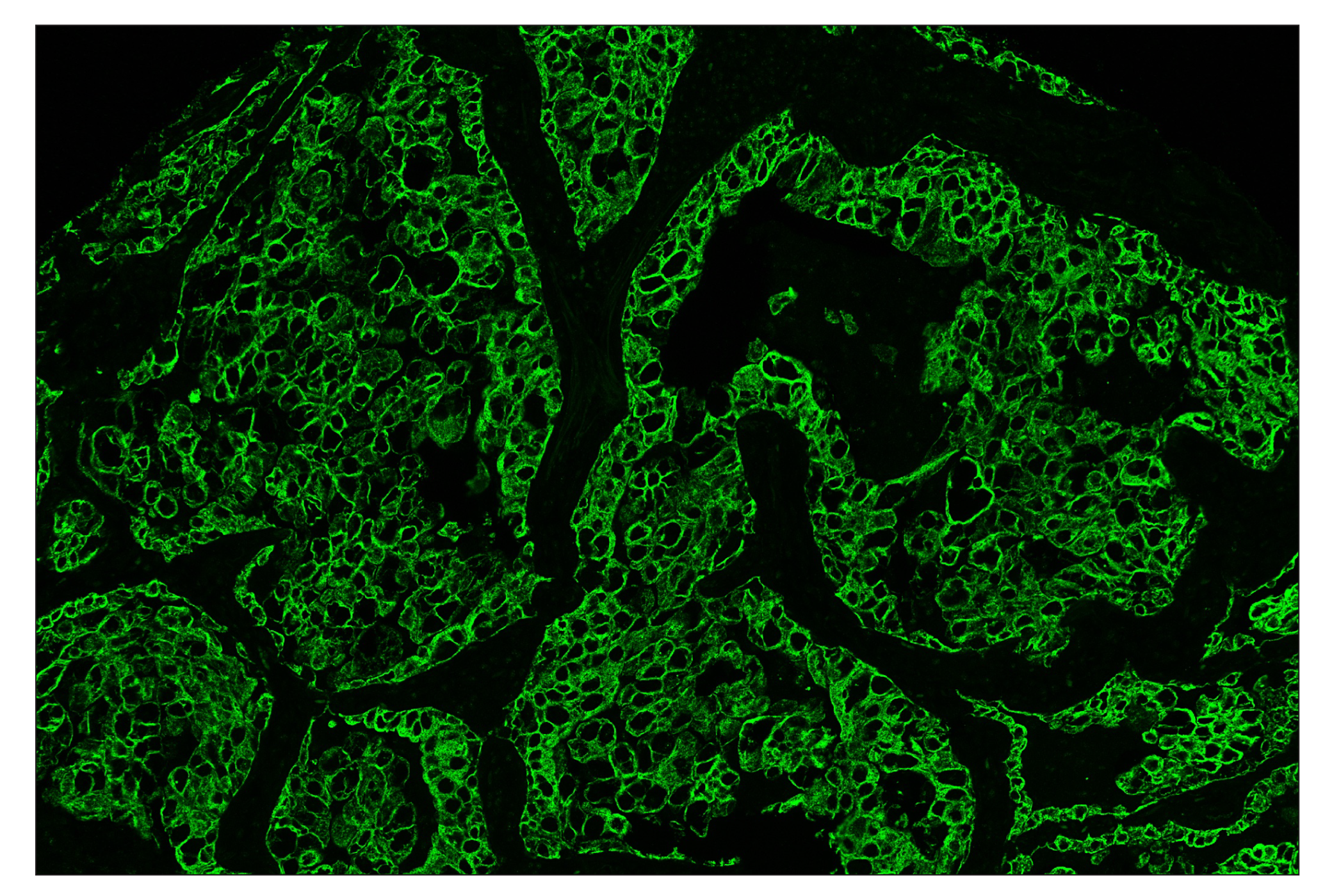 Immunohistochemistry Image 2: Pan-Keratin (C11) & CO-0003-647 SignalStar™ Oligo-Antibody Pair