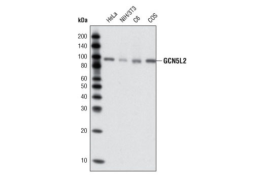  Image 3: Lysine Acetyltransferase Antibody Sampler Kit